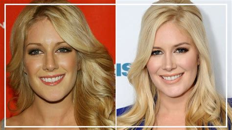 Heidi Montag's Physical Transformation: Plastic Surgery and Body Image