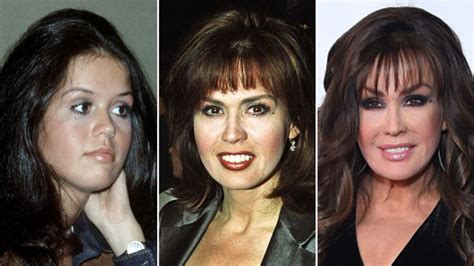 Marie Osmond's Journey to Stardom: Evolution of Age, Stature, and Silhouette