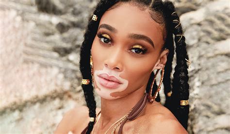 The Journey of Self-Assurance: Winnie Harlow's Personal Triumph